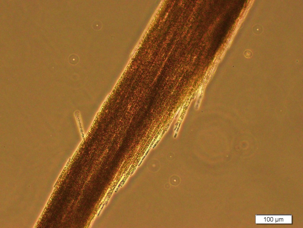 Marras15_Aphanizomenon_colony_fluorescence_microscopy